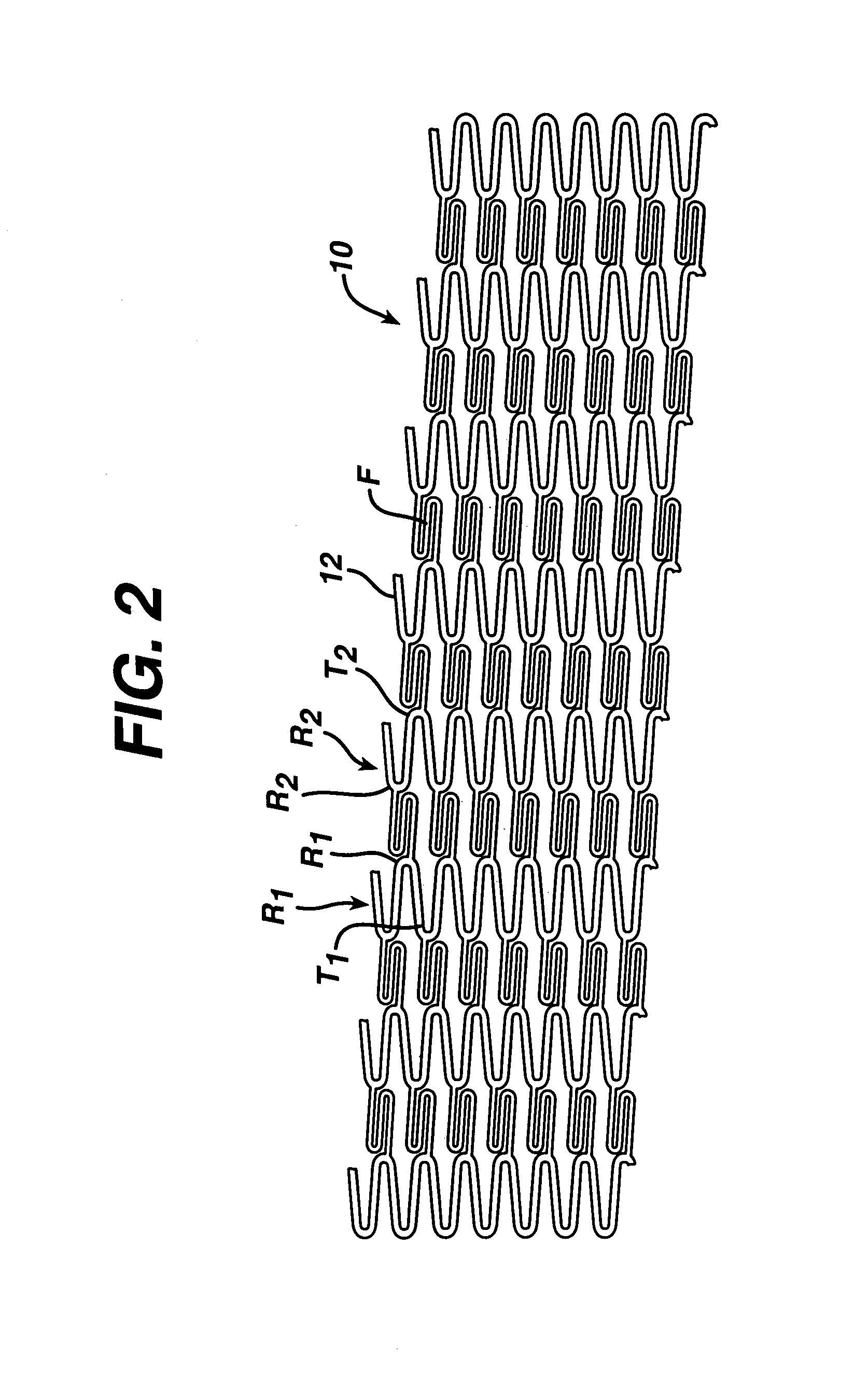 Stent with enhanced crossability