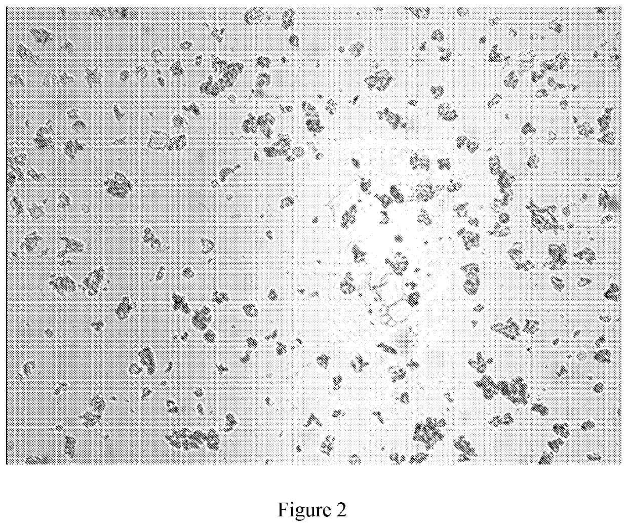 Liposomes encapsulating adenosine