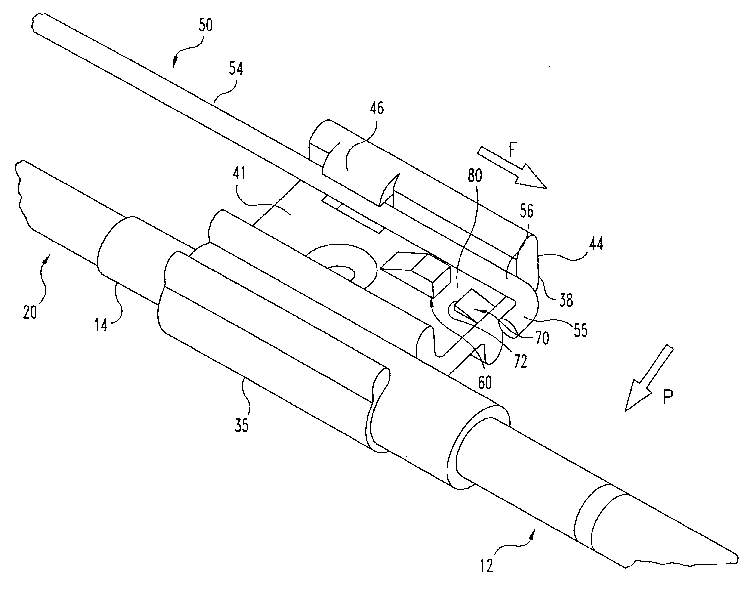 Biopsy needle with integrated guide pin