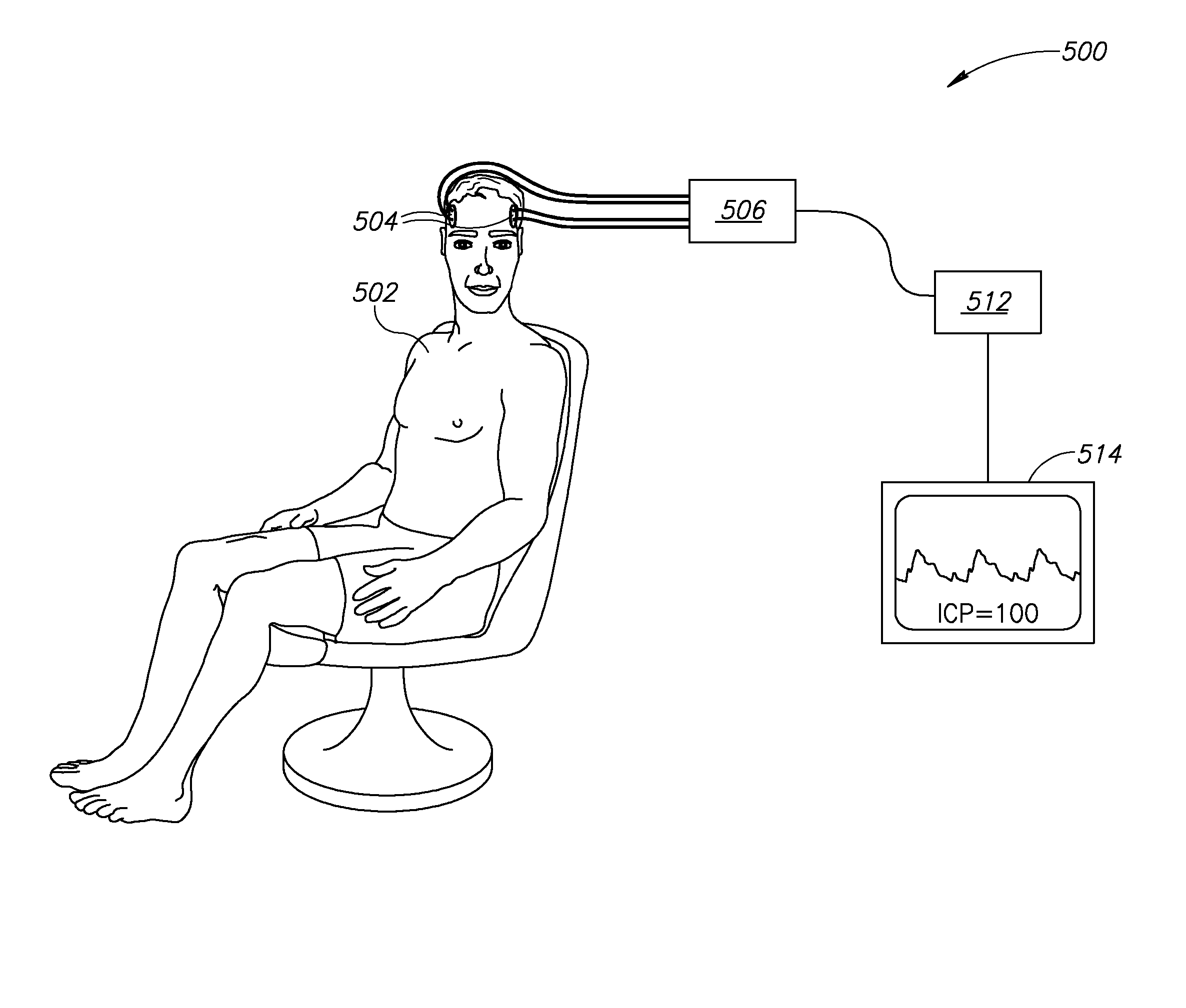 Non-Invasive Intracranial Monitor