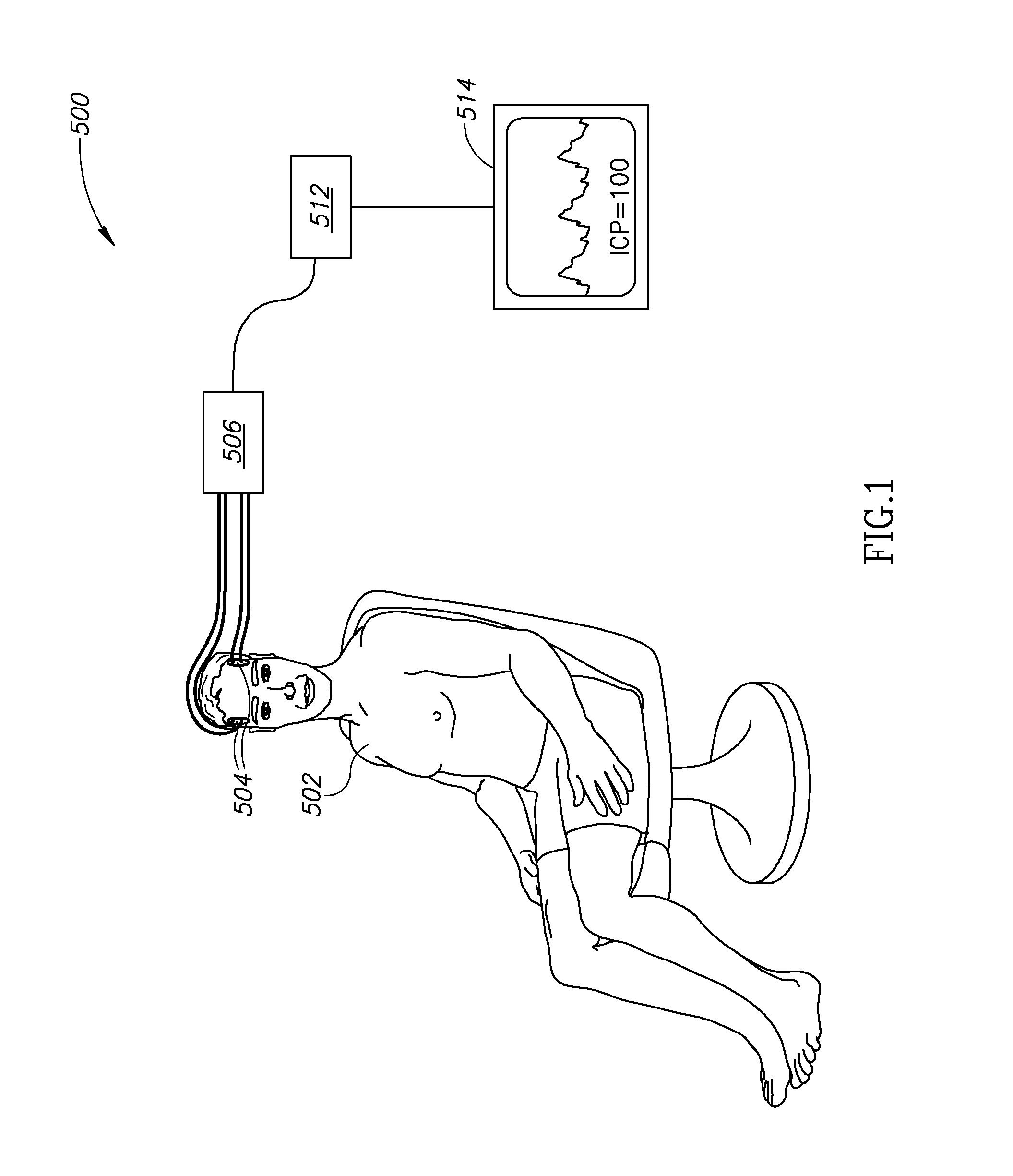 Non-Invasive Intracranial Monitor