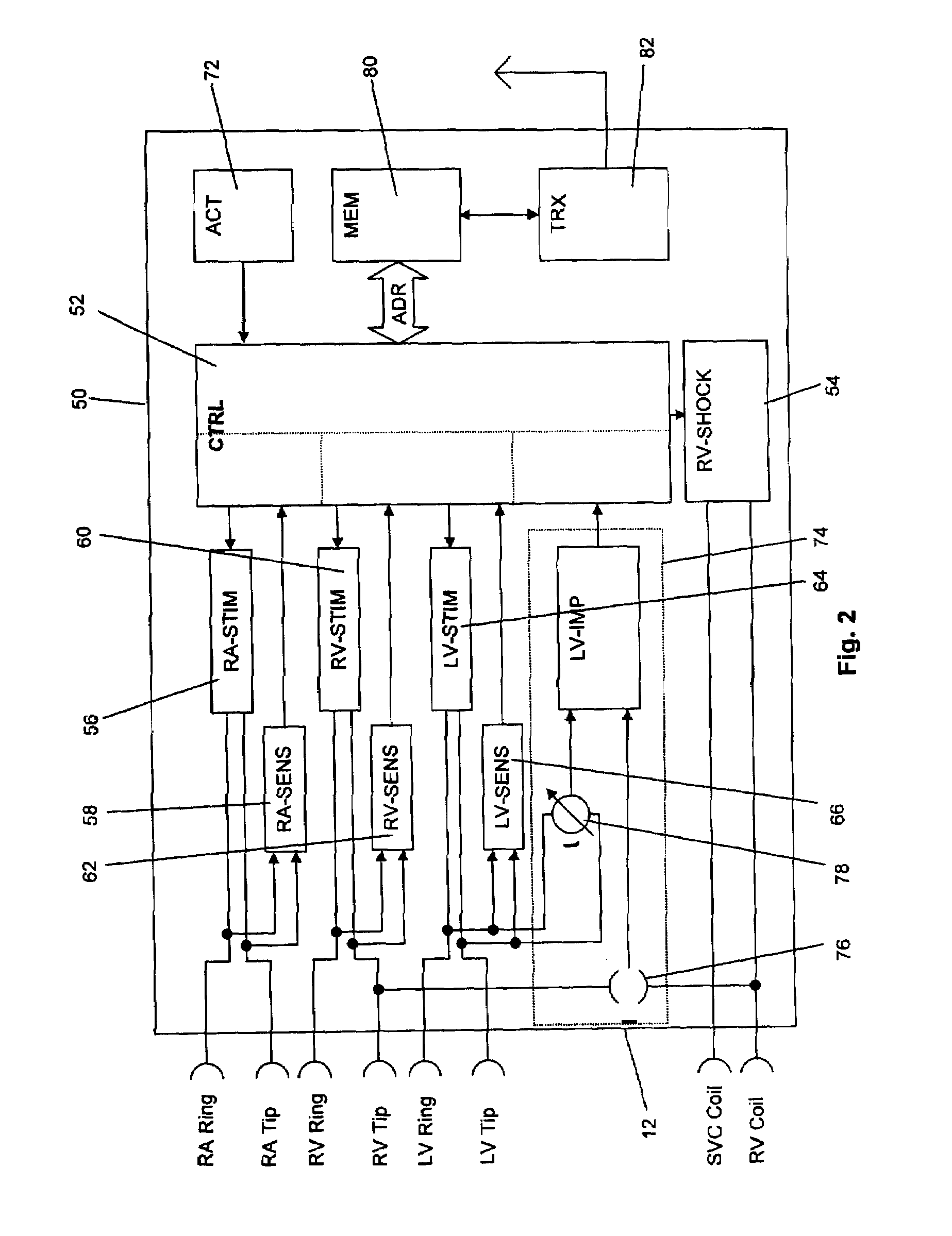 Implantable medical device and method for lv coronary sinus lead implant site optimization