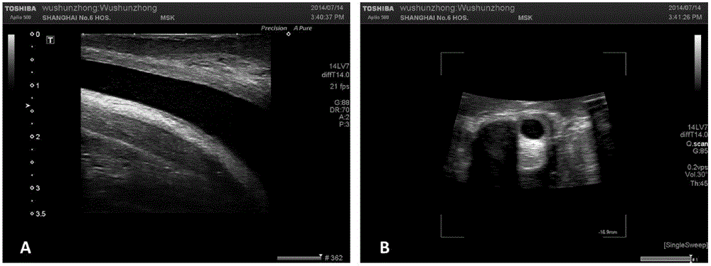 Method for constructing individualized human urethra tissue digital model