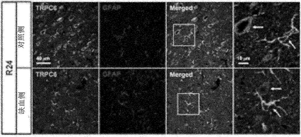 Target spot and medicine for treating cerebral injury