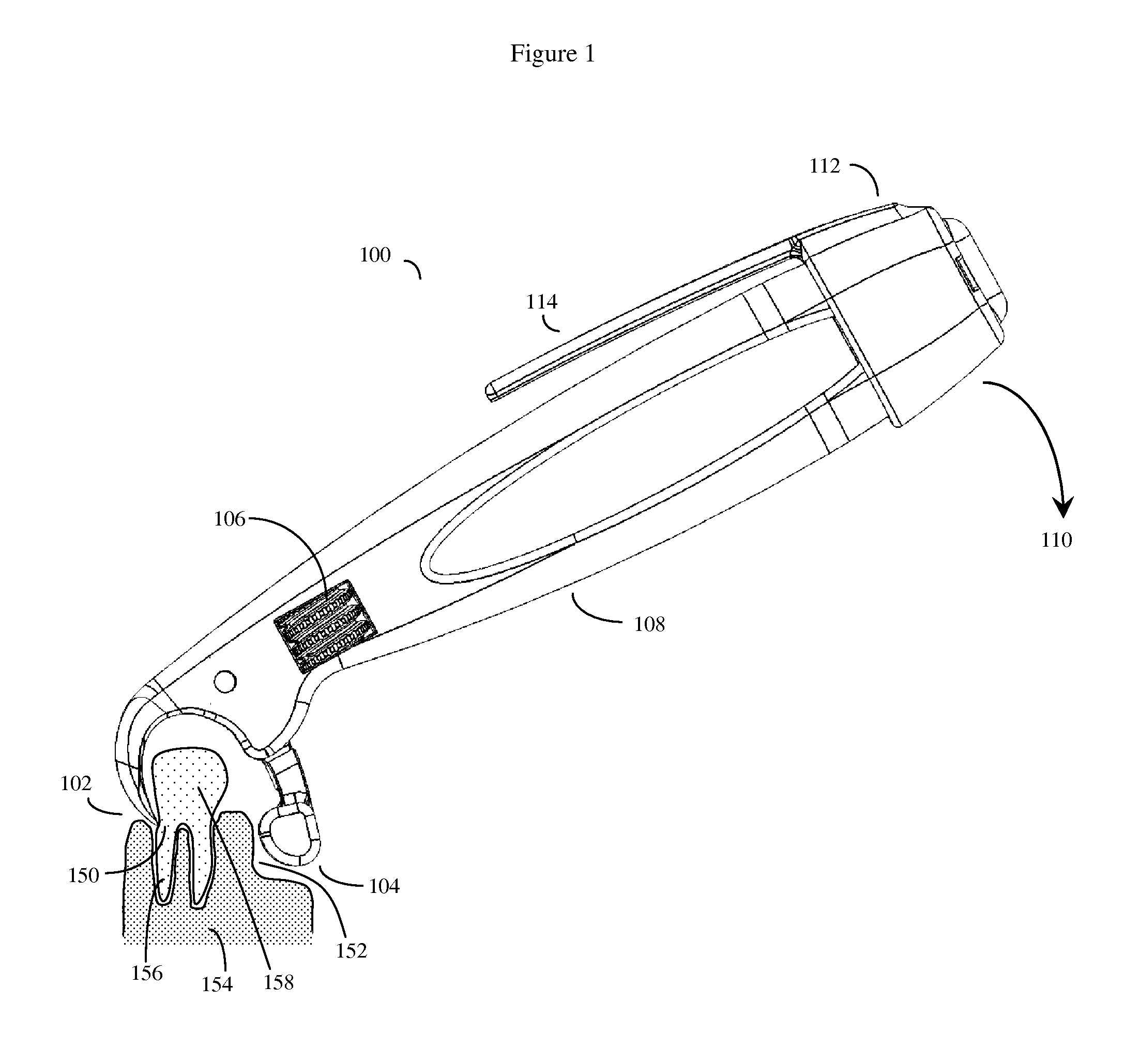 Dental fulcrum wrench