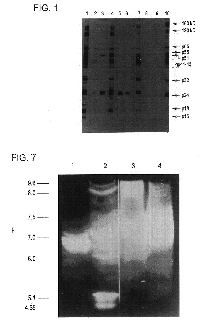 Anti-idiotypic antibody and its use in regulating the composition of T cell lymphocytes