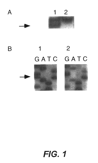 Androgen-metabolic gene mutations and prostate cancer risk