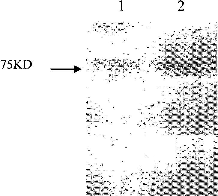 Method for producing recombinant human epidermal growth factor acceptor 2 cytoplasmic region with methylotrophy yeast