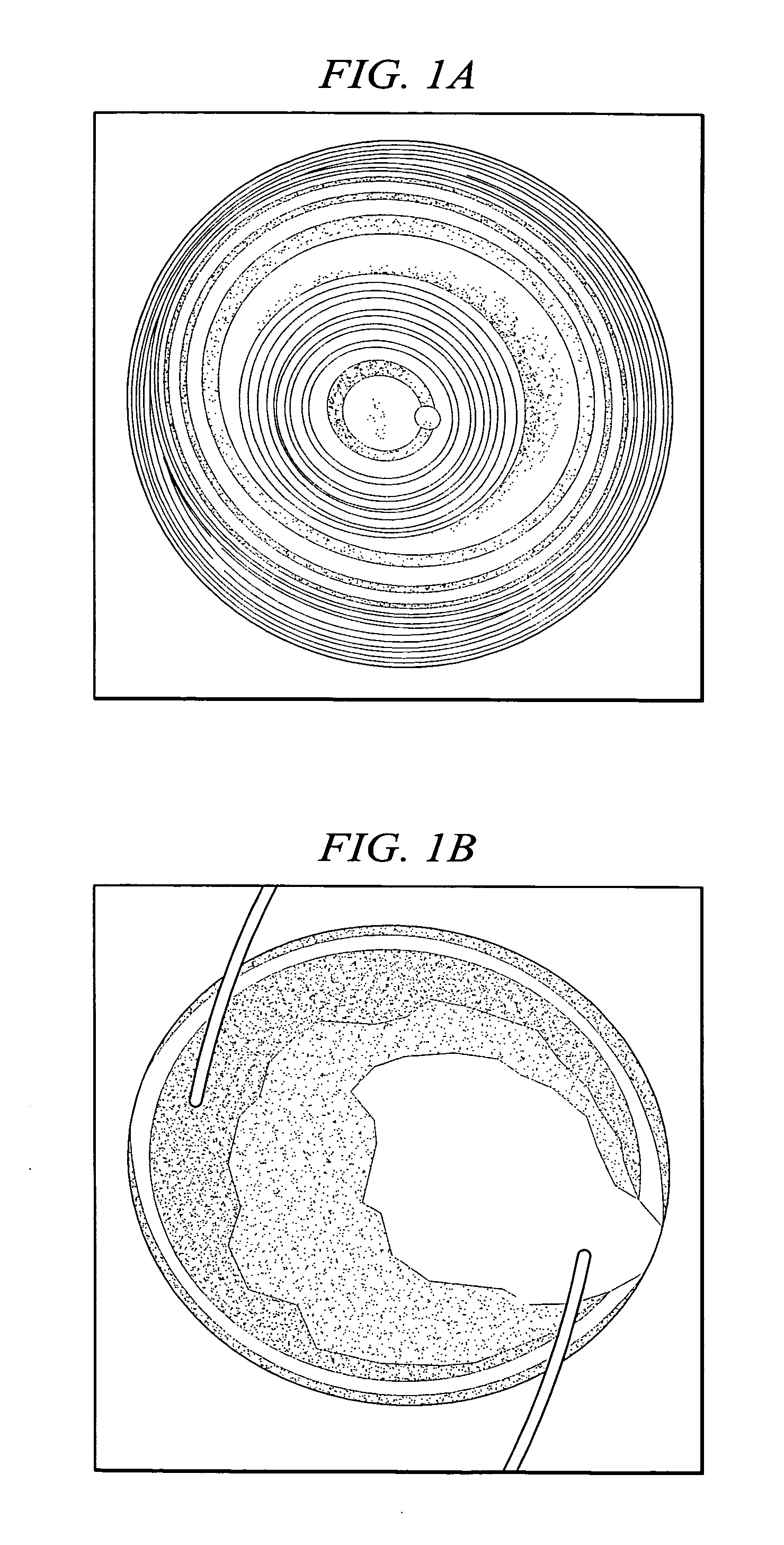 Light adjustable multifocal lenses