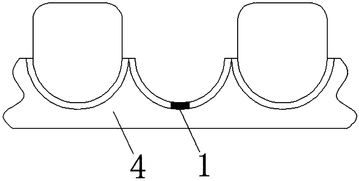 Preparation method of surgical guiding template used for oral implant surgery