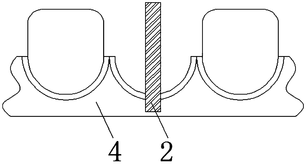 Preparation method of surgical guiding template used for oral implant surgery