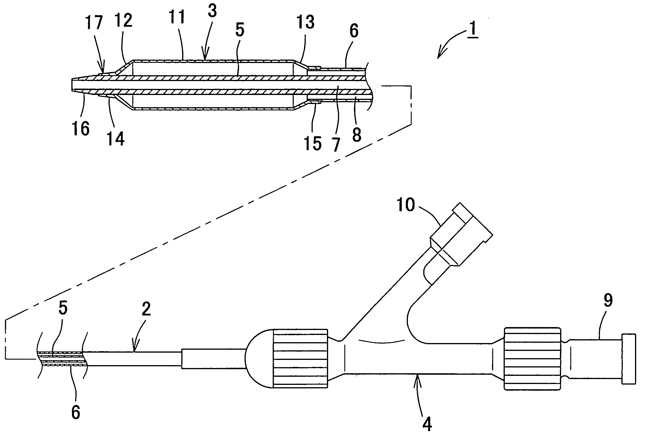 Balloon catheter