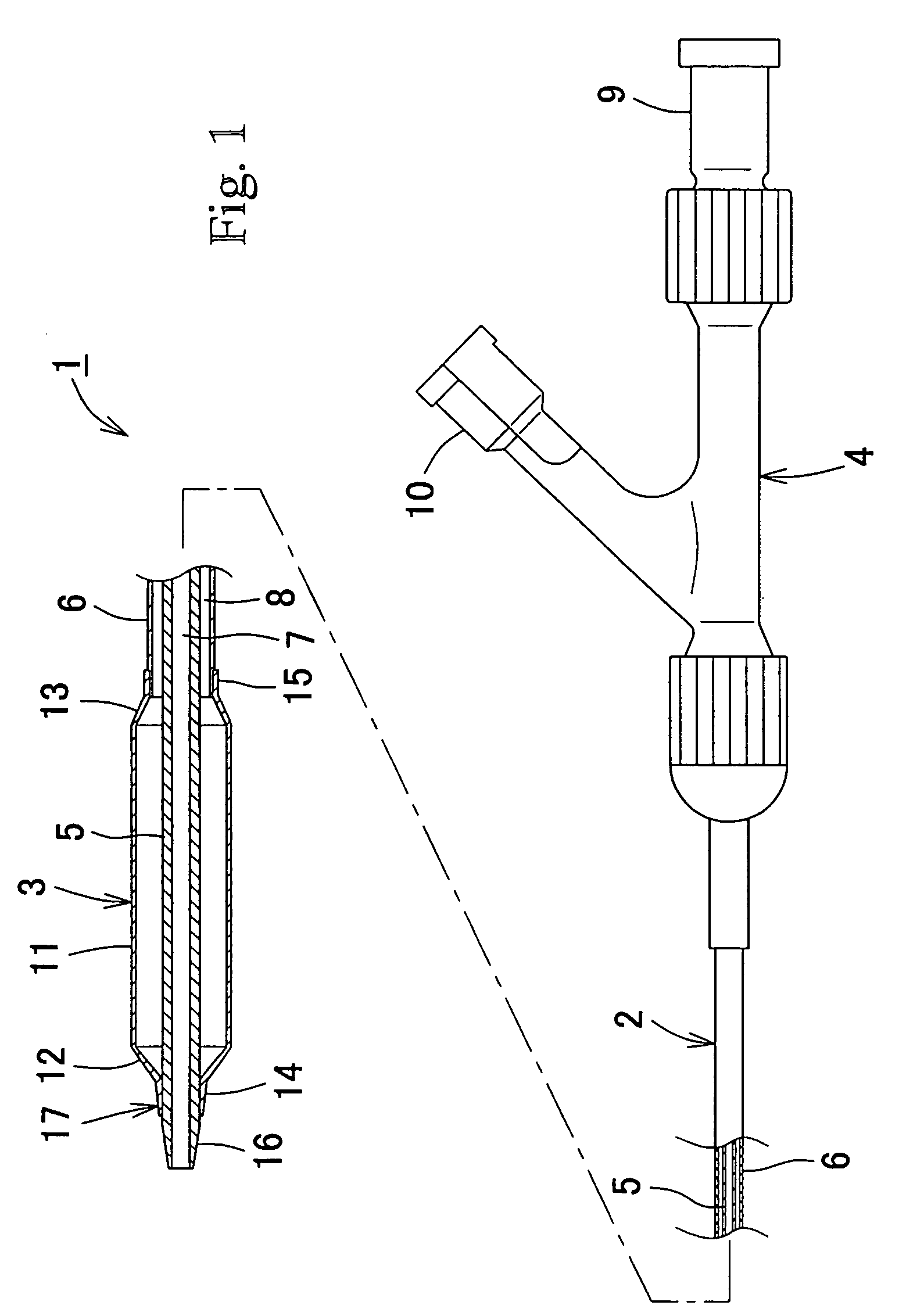 Balloon catheter