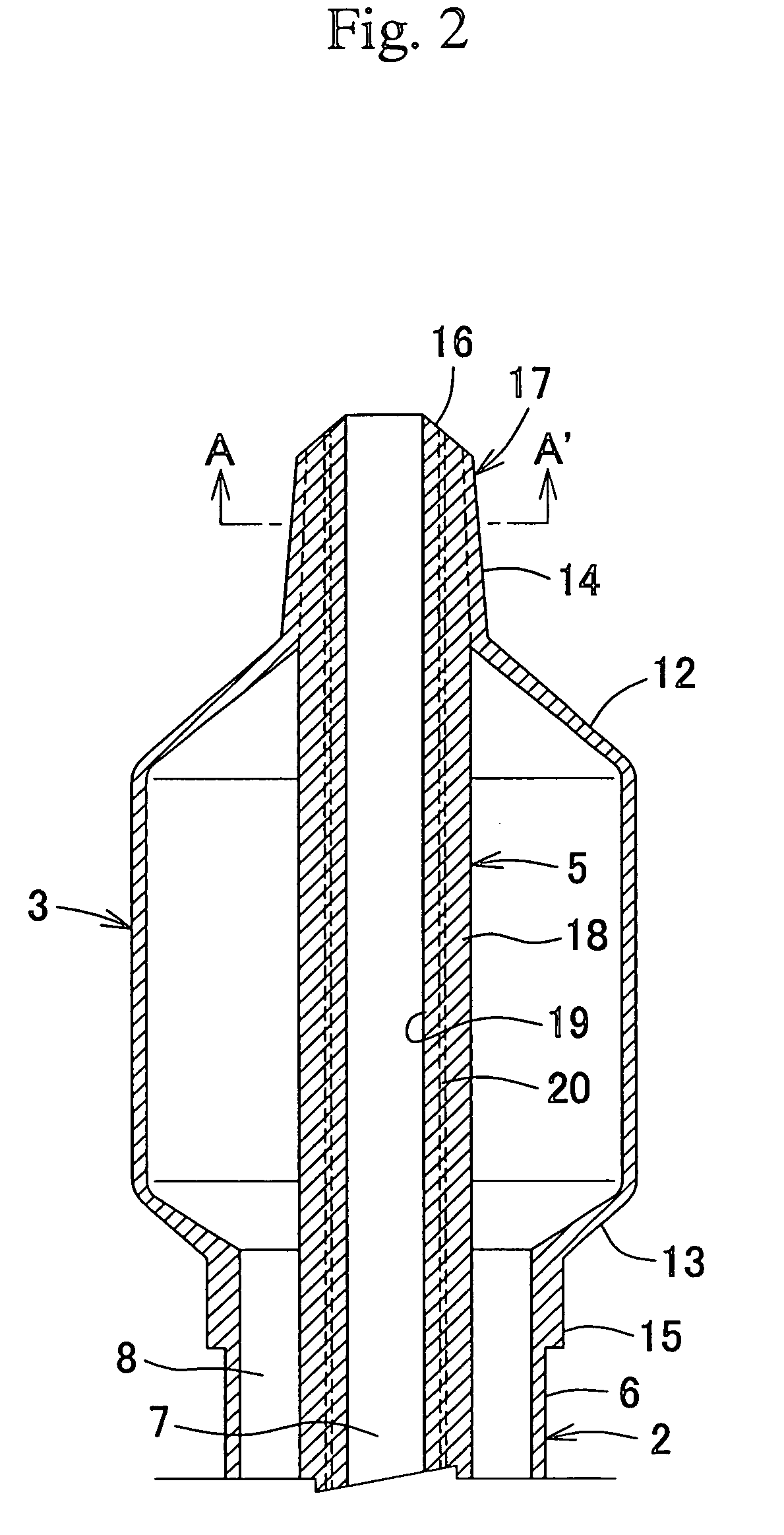 Balloon catheter