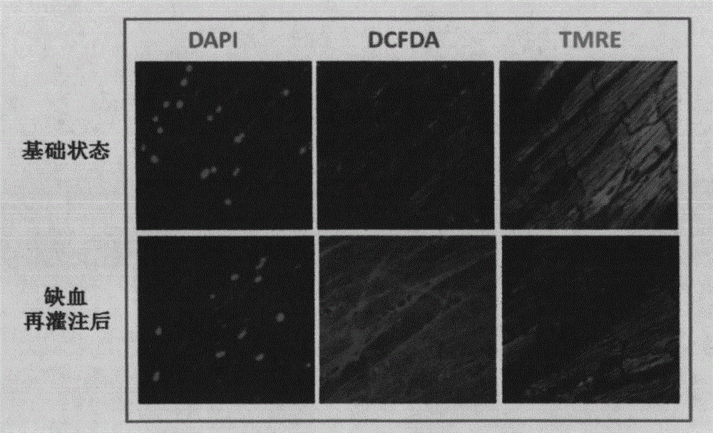 A method for detecting reactive oxygen species and mitochondrial membrane potential in isolated perfused hearts