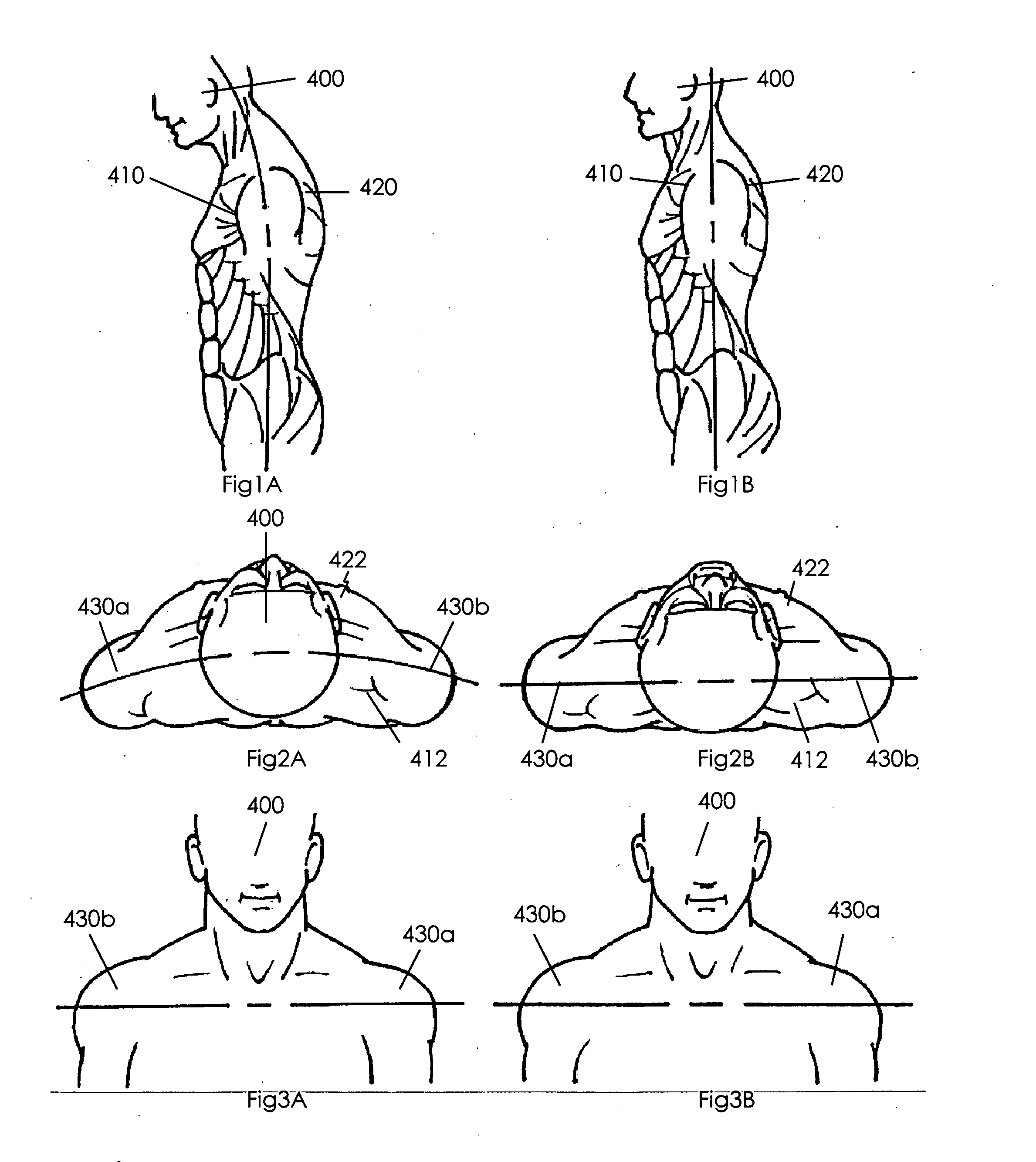 Method and apparatus for torso muscle lengthening