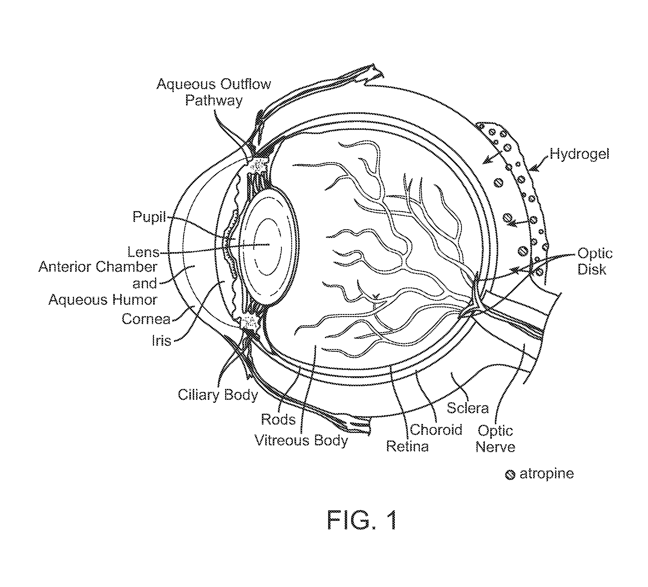 Implantable Delivery Vehicle for Ocular Delivery of Muscarinic Antagonists