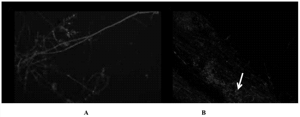 Rapeseed endogenous trichoderma atroviride ReTv2 strain and preparation method and application thereof