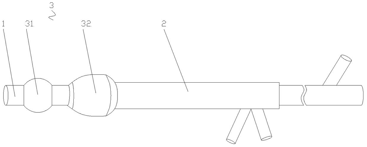 A double-sleeved fistula tube