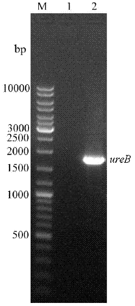 Immunologic adjuvant-Helicobacter pylori antigen fused protein oral vaccine and preparation method thereof