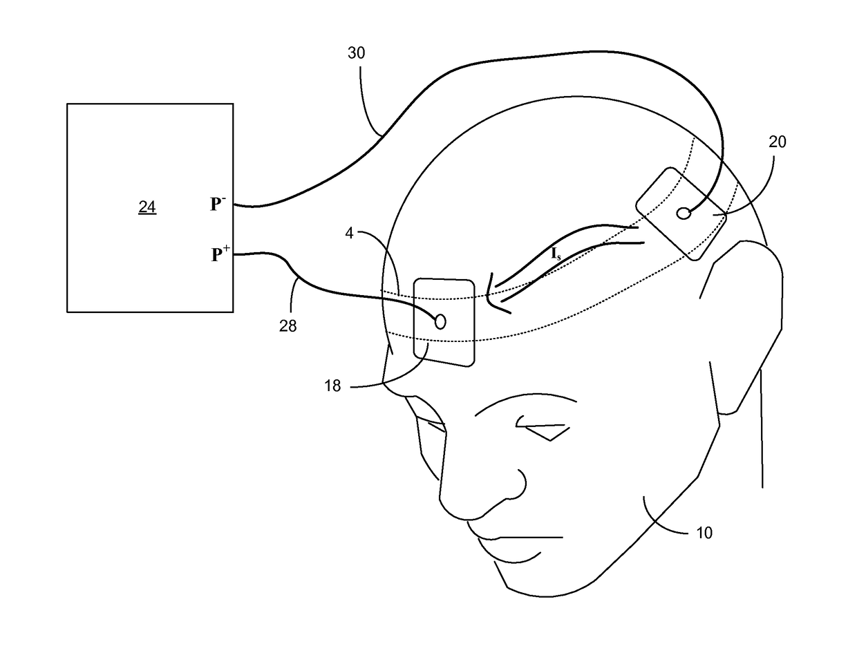 Transcranial direct current brain stimulation apparatus