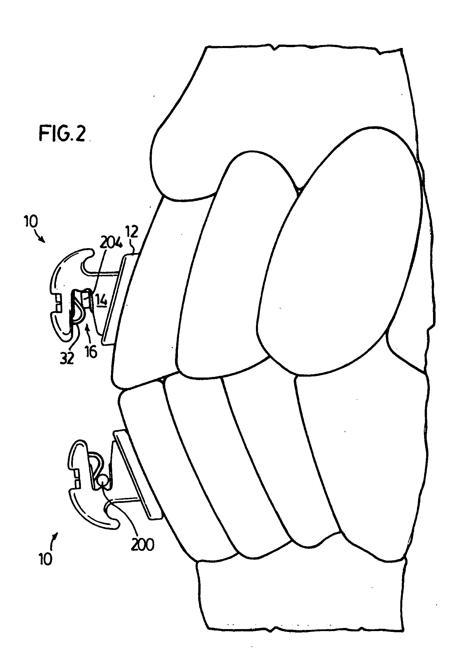 Orthodontic bracket system