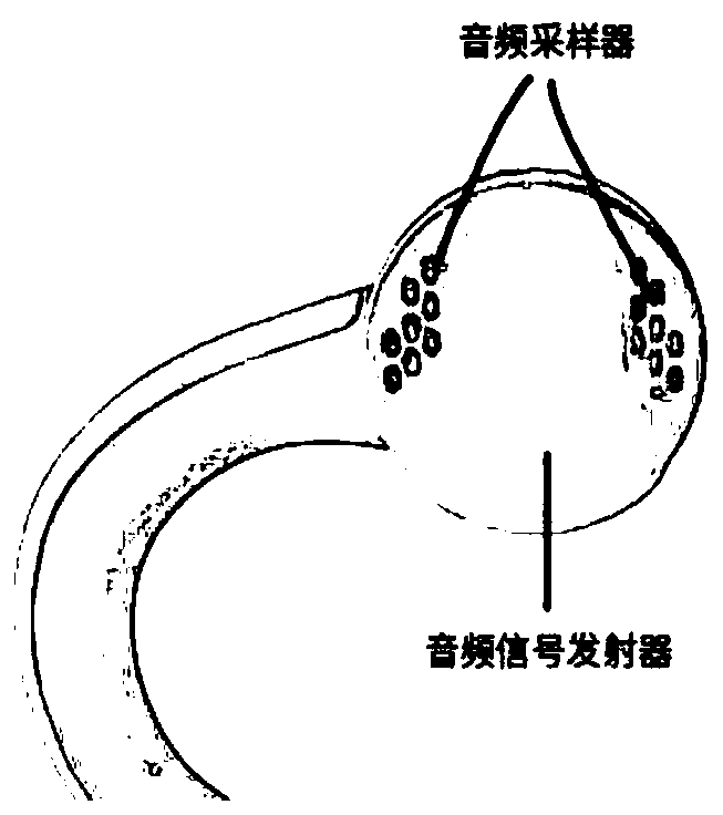 Electronic snore-ceasing equipment