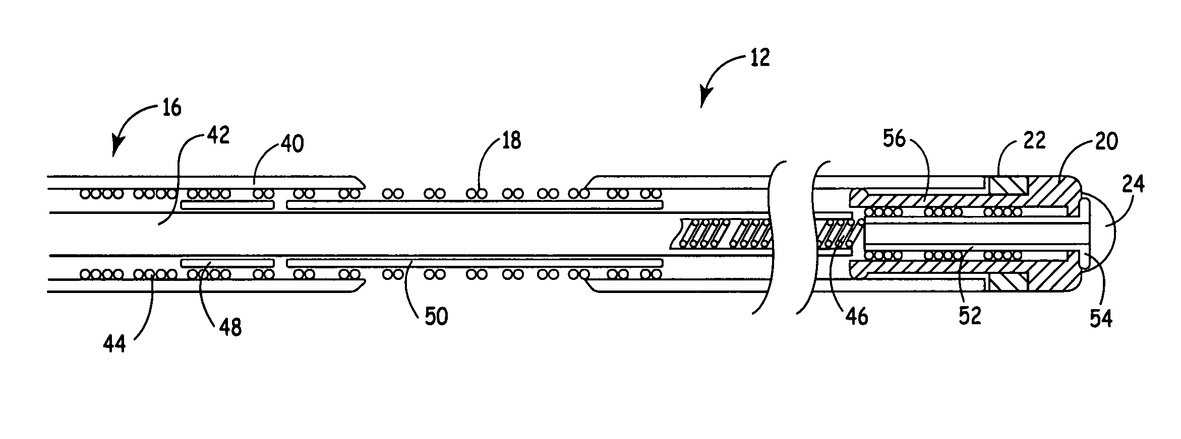 Cardiac vein lead with flexible anode and method for forming same