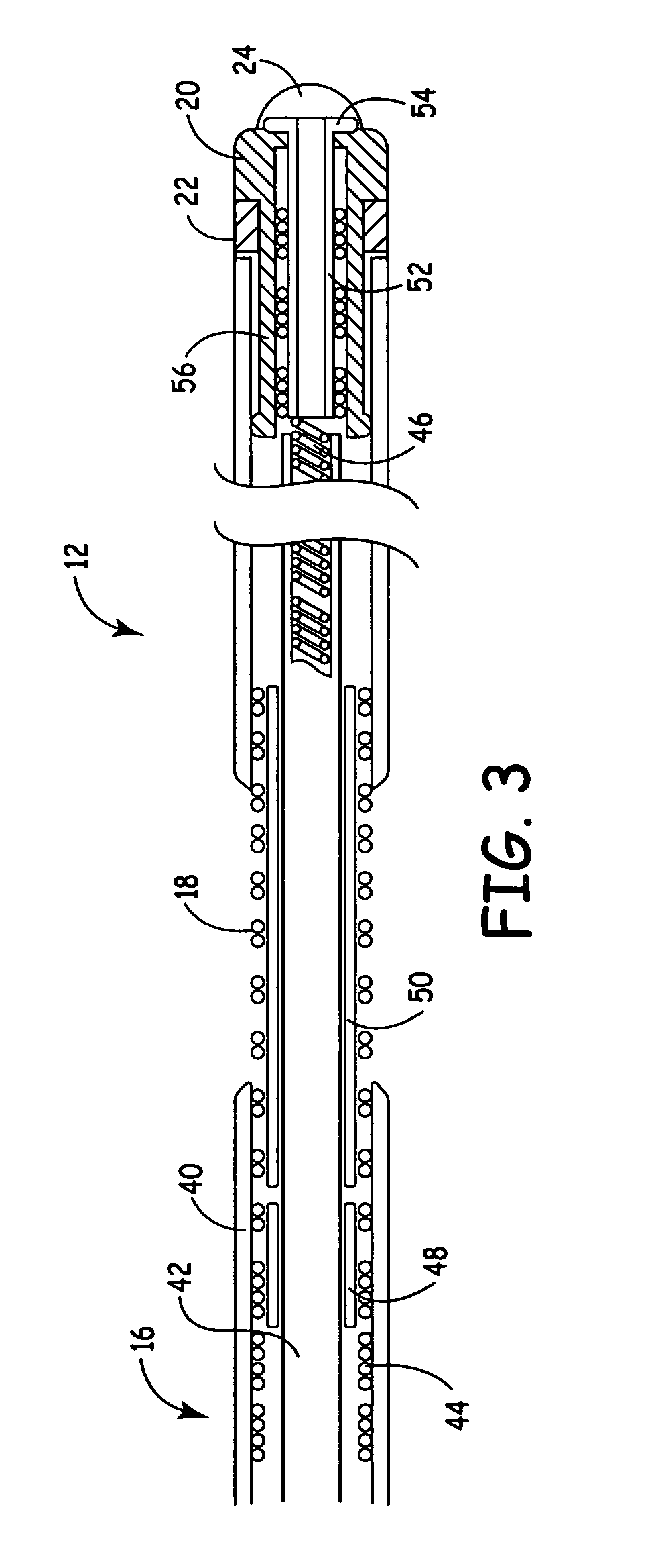 Cardiac vein lead with flexible anode and method for forming same