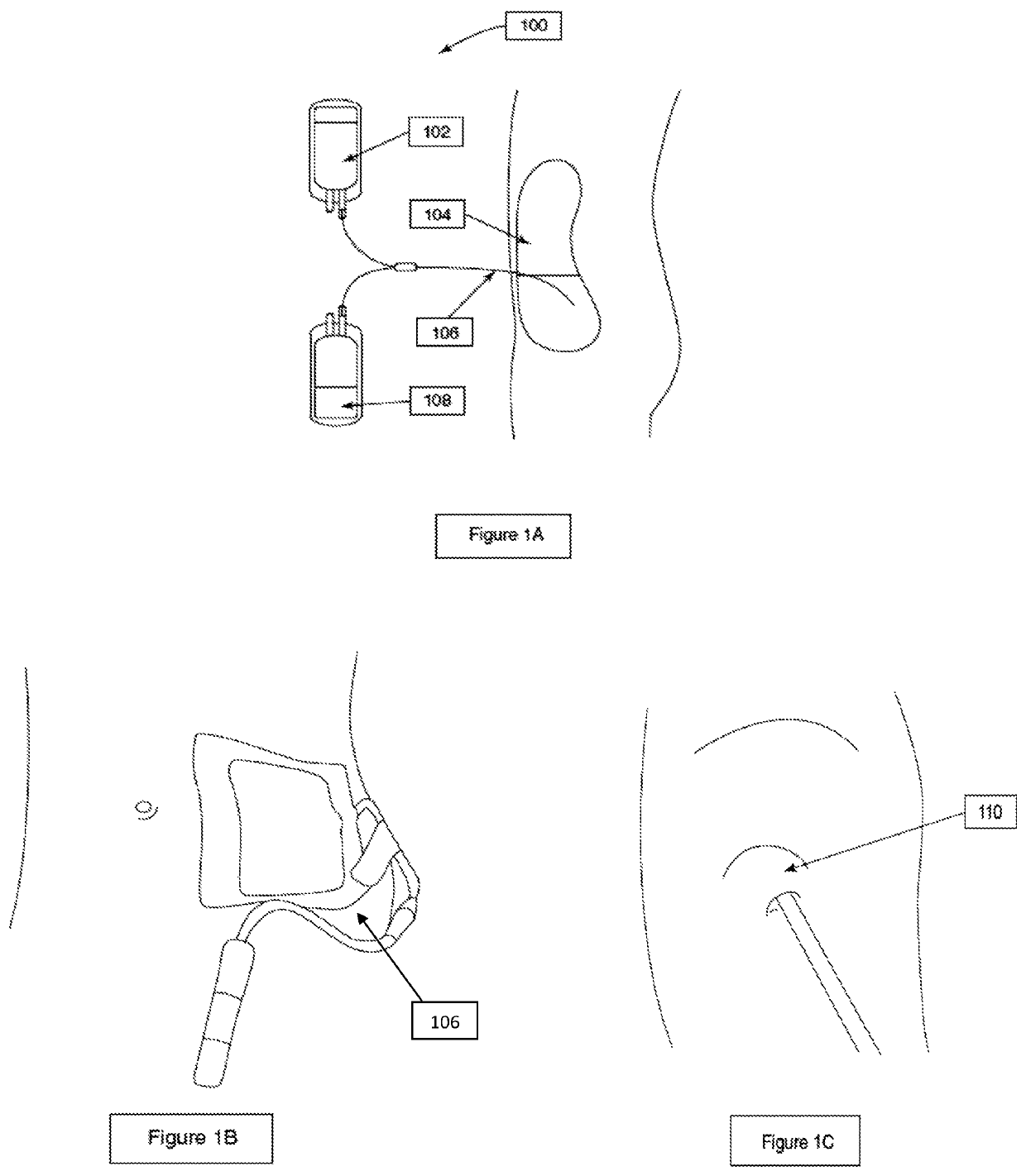 Medicated patch for preventing exit site infections during peritoneal dialysis