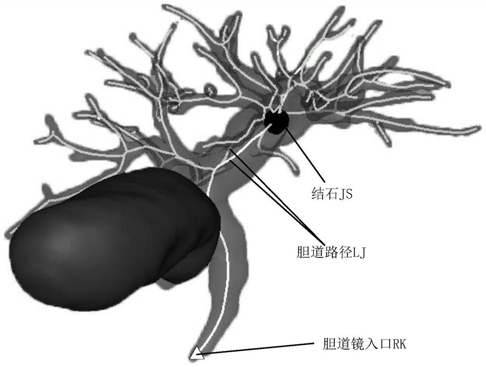 Virtual choledochoscope interventional operation planning method, device and apparatus and storage medium