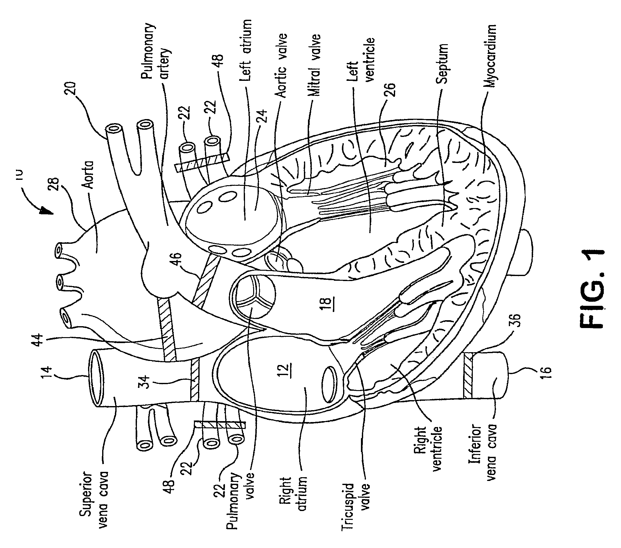 Cardiac targeted delivery of cells