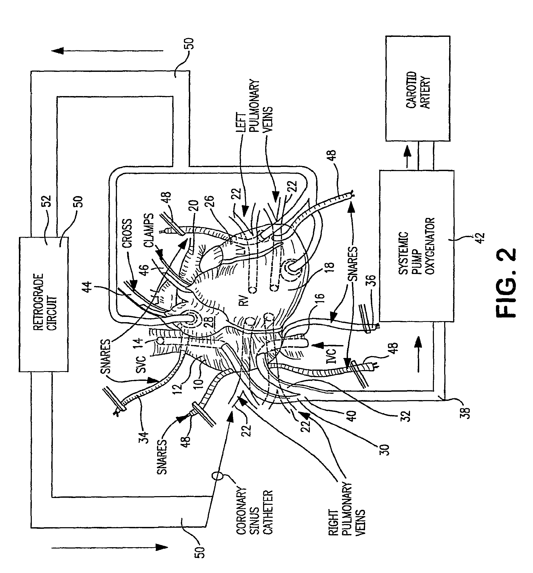 Cardiac targeted delivery of cells