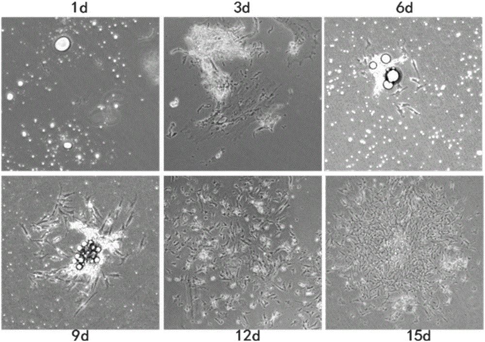 Method for separating and purifying high-purity chicken-precursor intramuscular fat cells and establishing intramuscular-fat-cell-and-muscle-satellite-cell co-culturing system