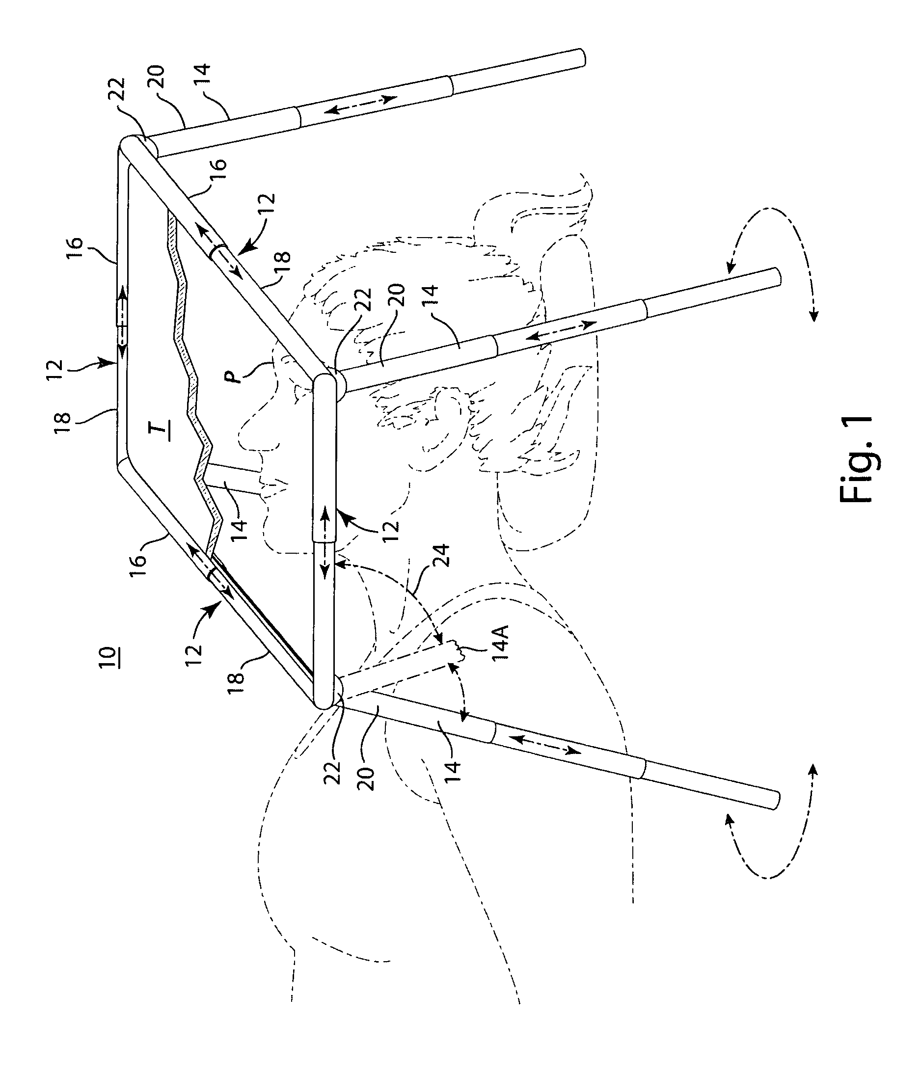 Support arrangement for an inverted tablet