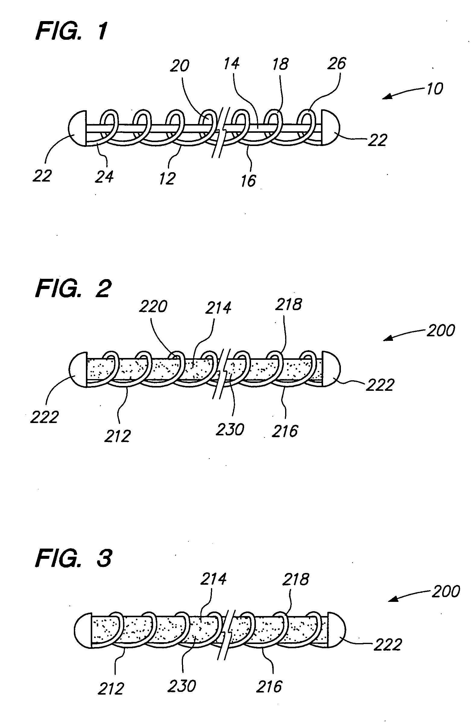 Vaso-occlusive devices with in-situ stiffening elements