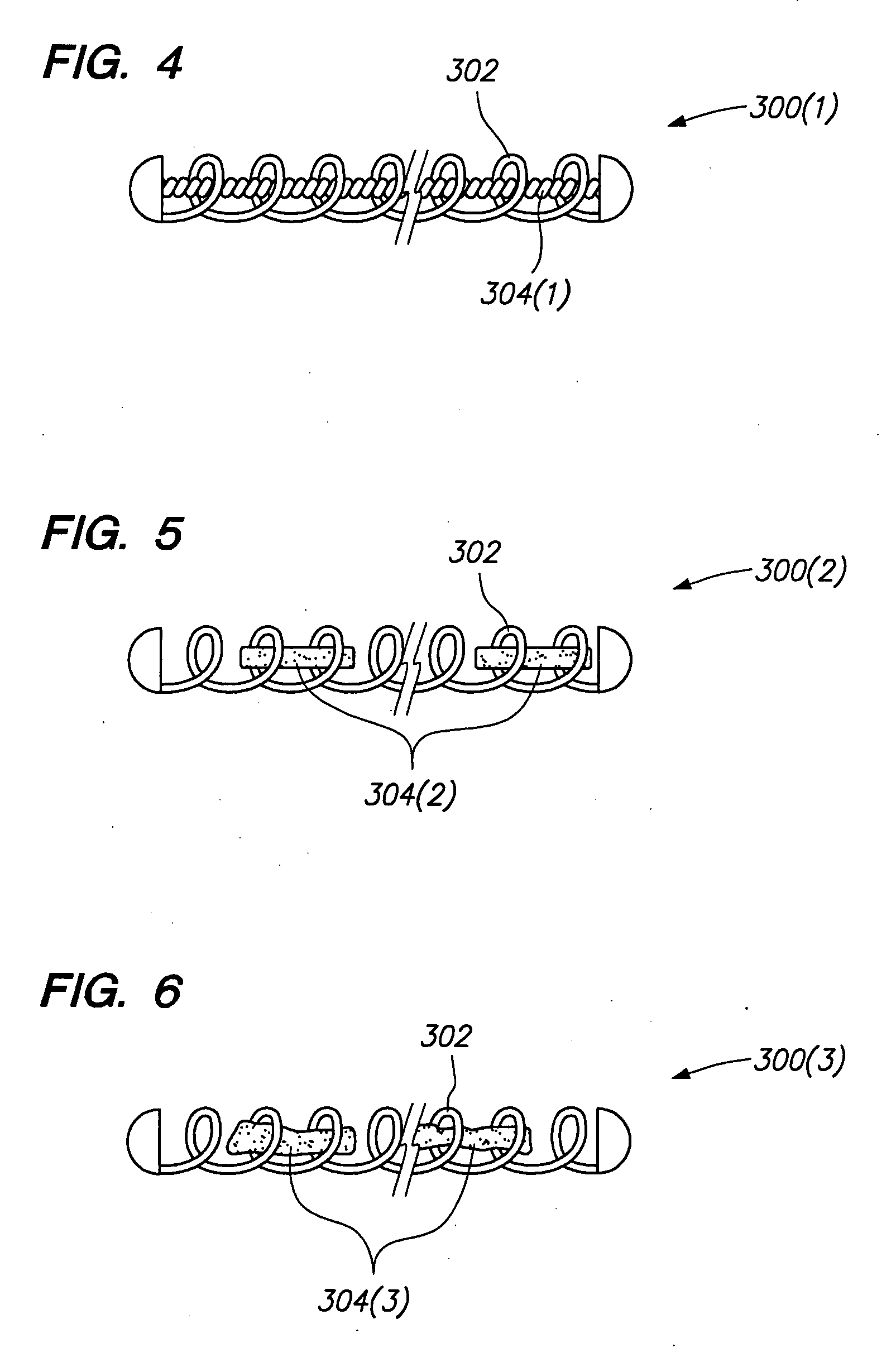 Vaso-occlusive devices with in-situ stiffening elements