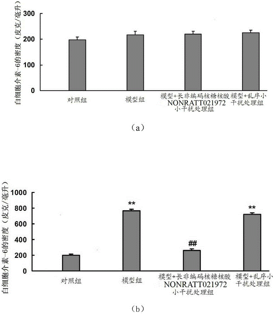 Use of NONRATT021972 small interfering RNA in preparation of drug for treating diabetes mellitus with cardiac autonomic nervous system diseases