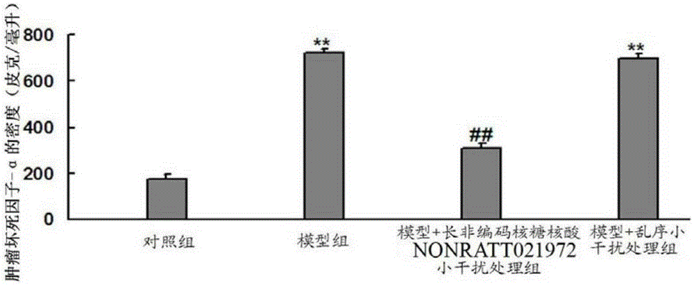 Use of NONRATT021972 small interfering RNA in preparation of drug for treating diabetes mellitus with cardiac autonomic nervous system diseases