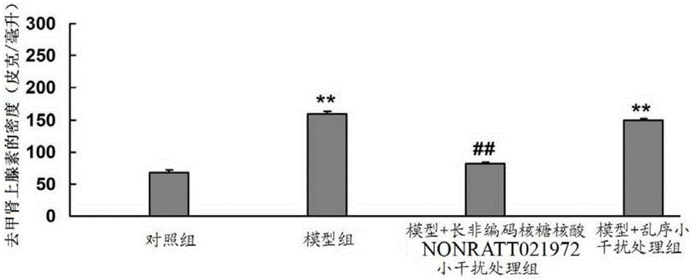 Use of NONRATT021972 small interfering RNA in preparation of drug for treating diabetes mellitus with cardiac autonomic nervous system diseases