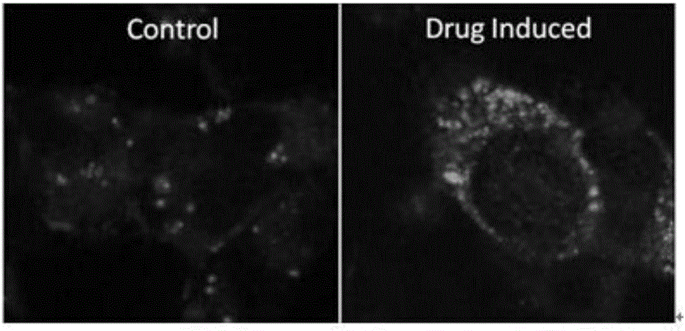 Culture medium additive for preparing autophagosomes-type tumor vaccine and preparing method thereof