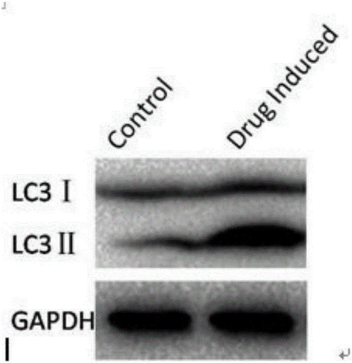 Culture medium additive for preparing autophagosomes-type tumor vaccine and preparing method thereof