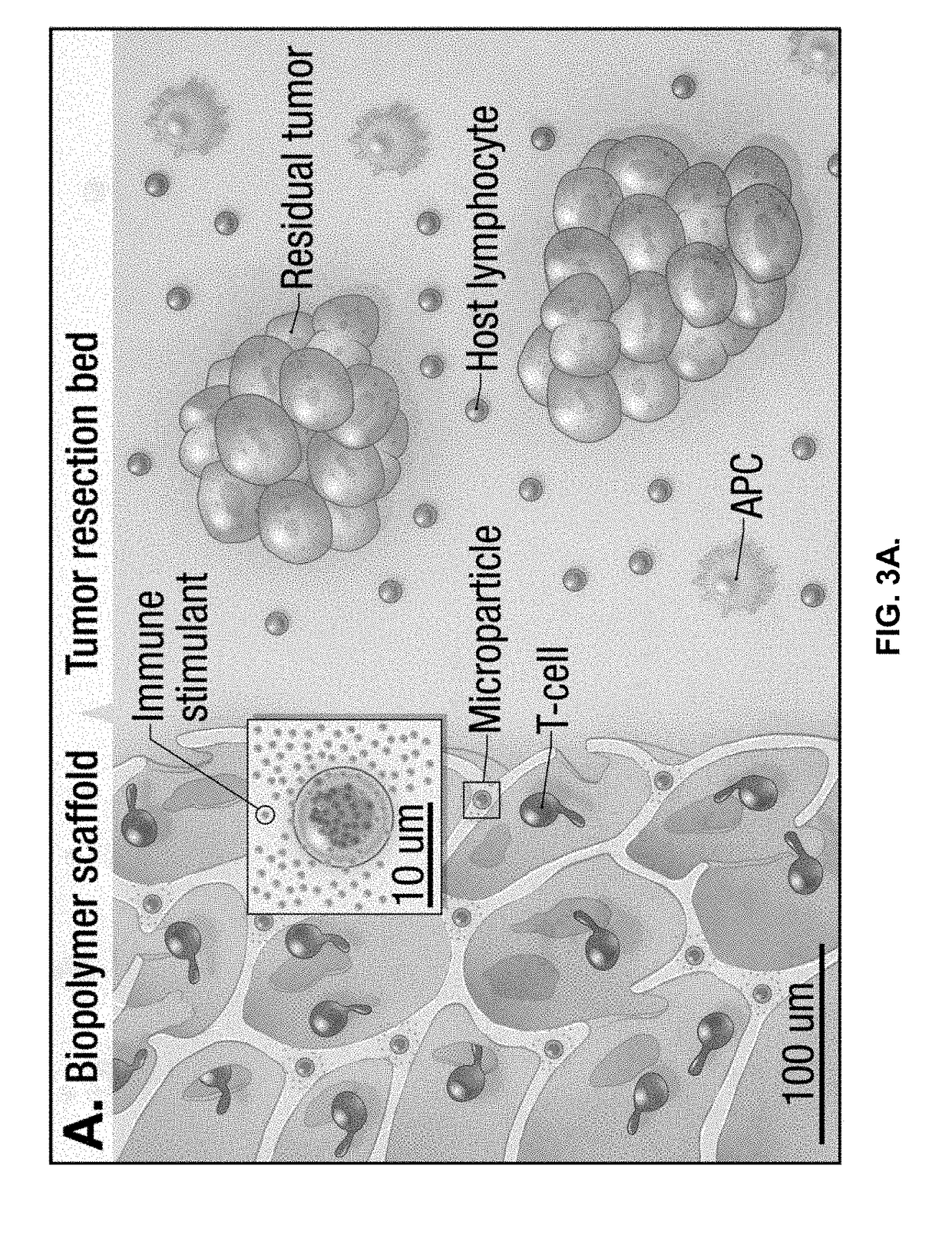 Compositions and methods for delivery of immune cells to treat un-resectable or non-resected tumor cells and tumor relapse