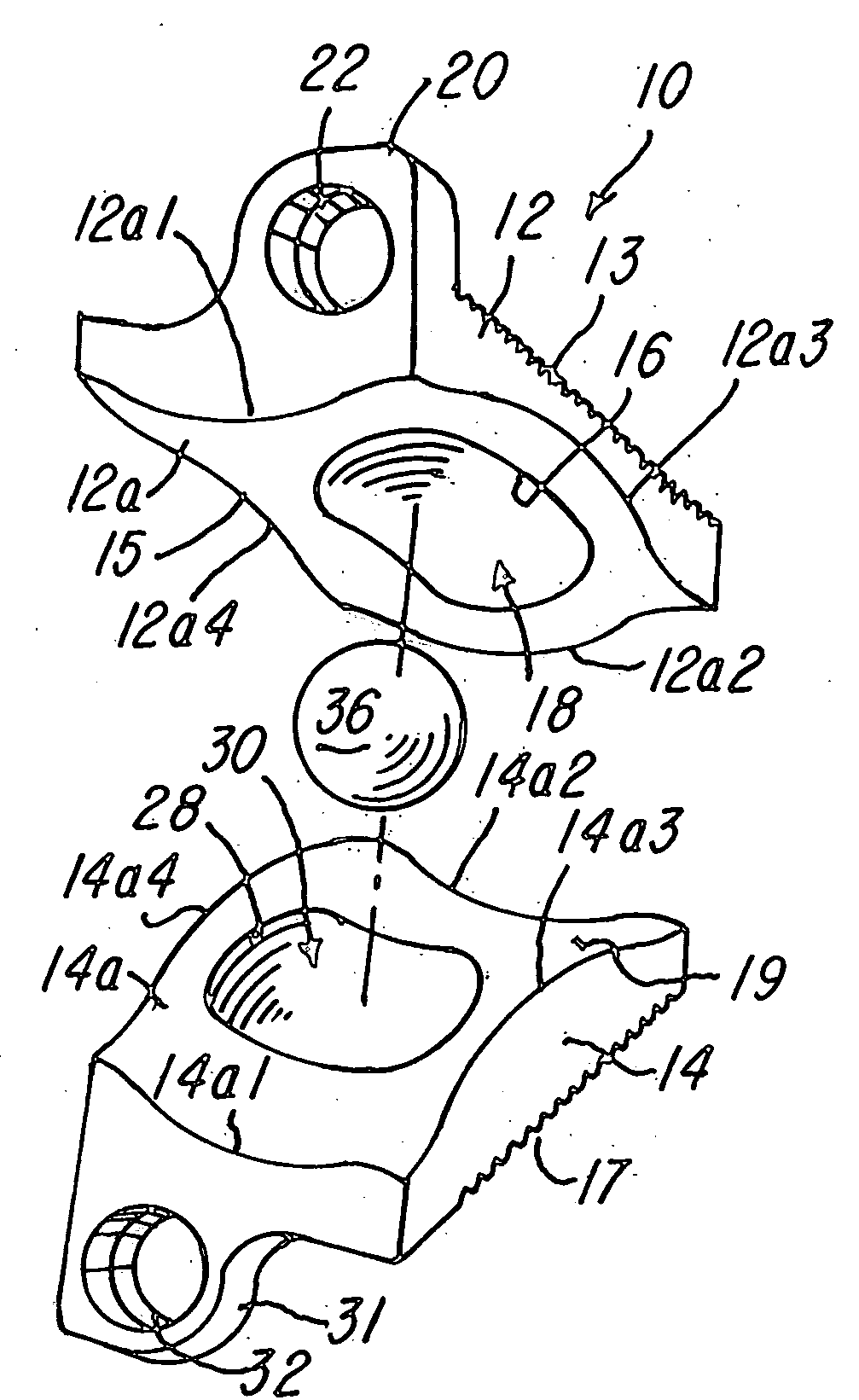 Prosthetic implant and method