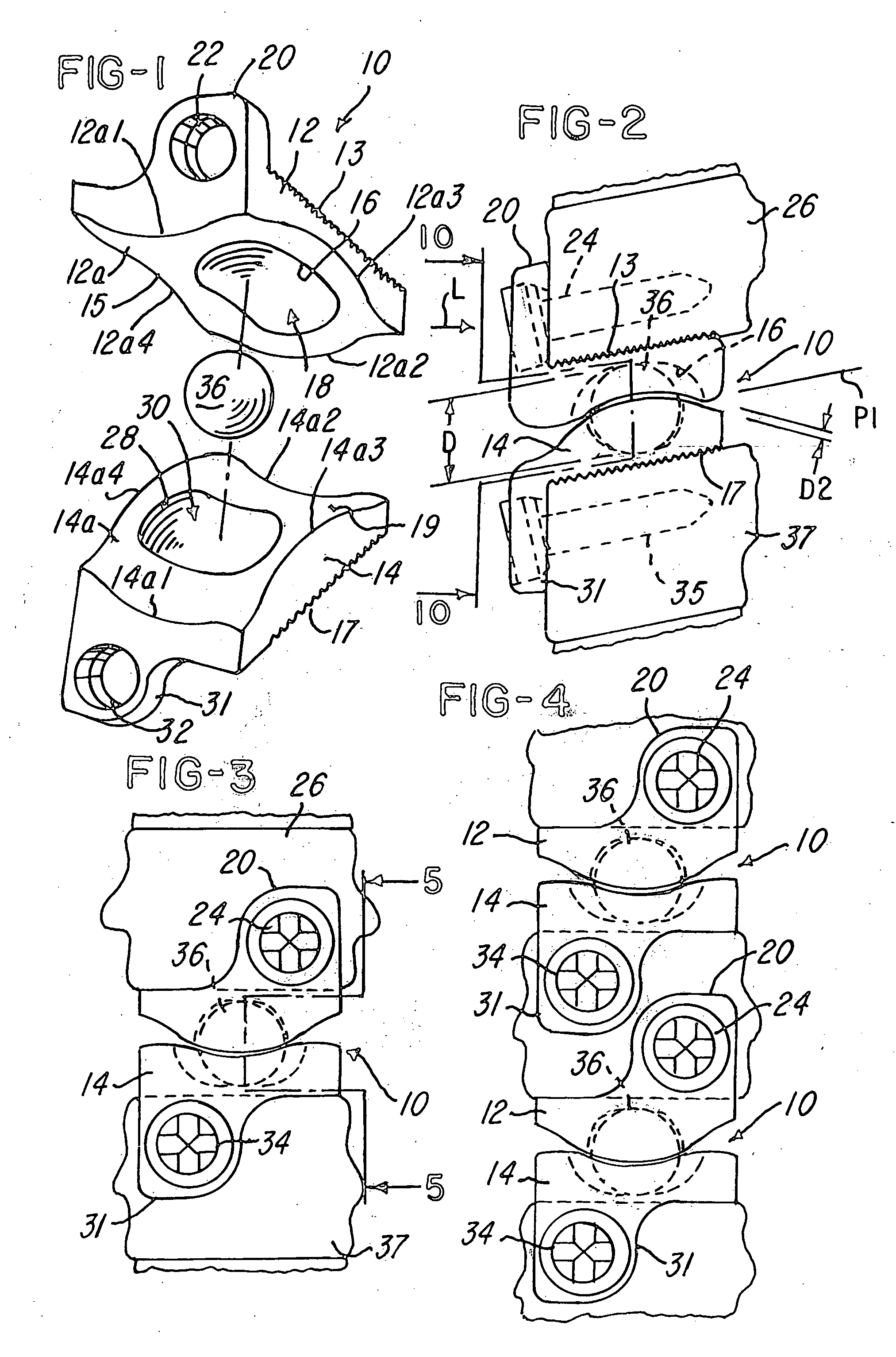 Prosthetic implant and method