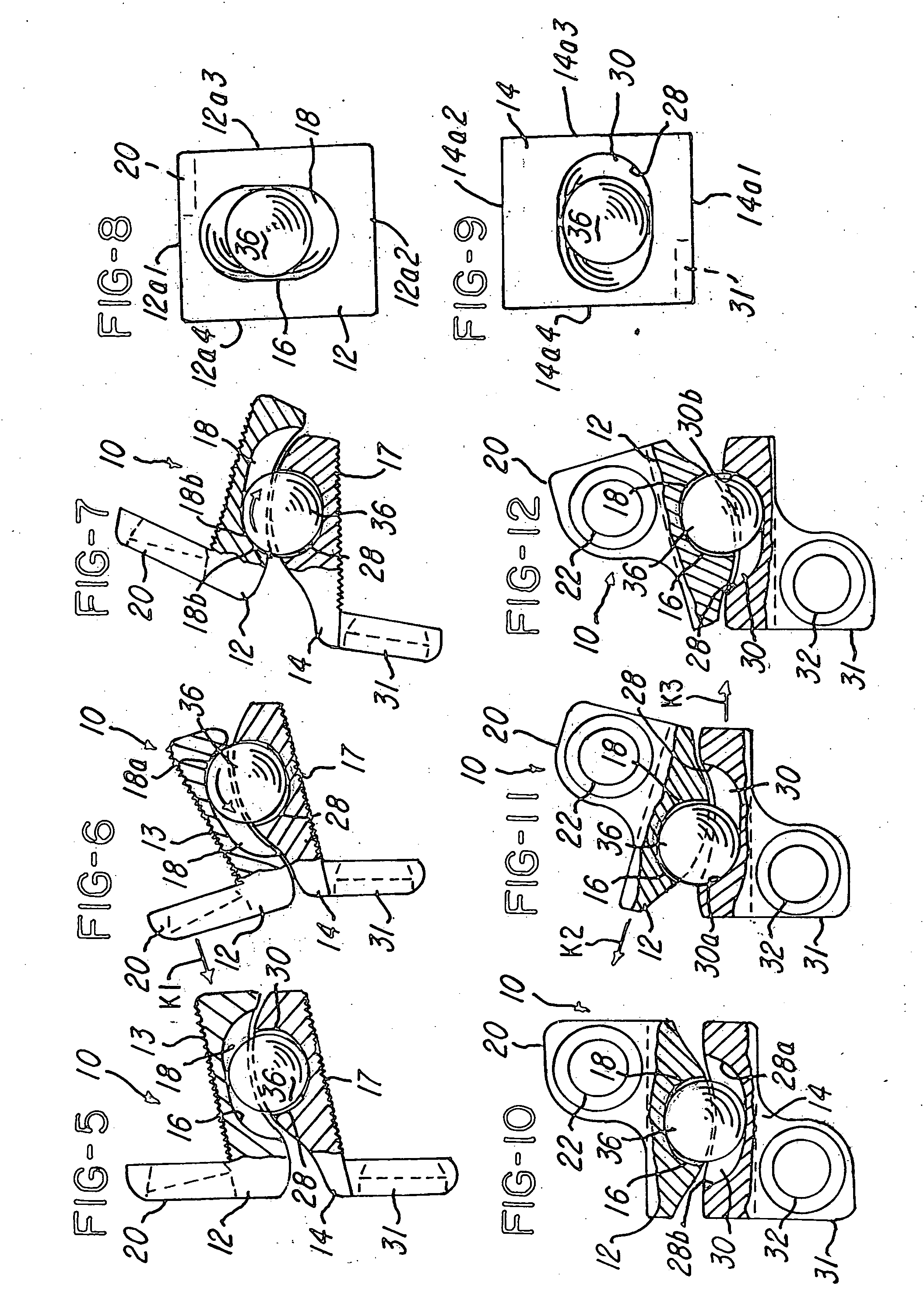 Prosthetic implant and method