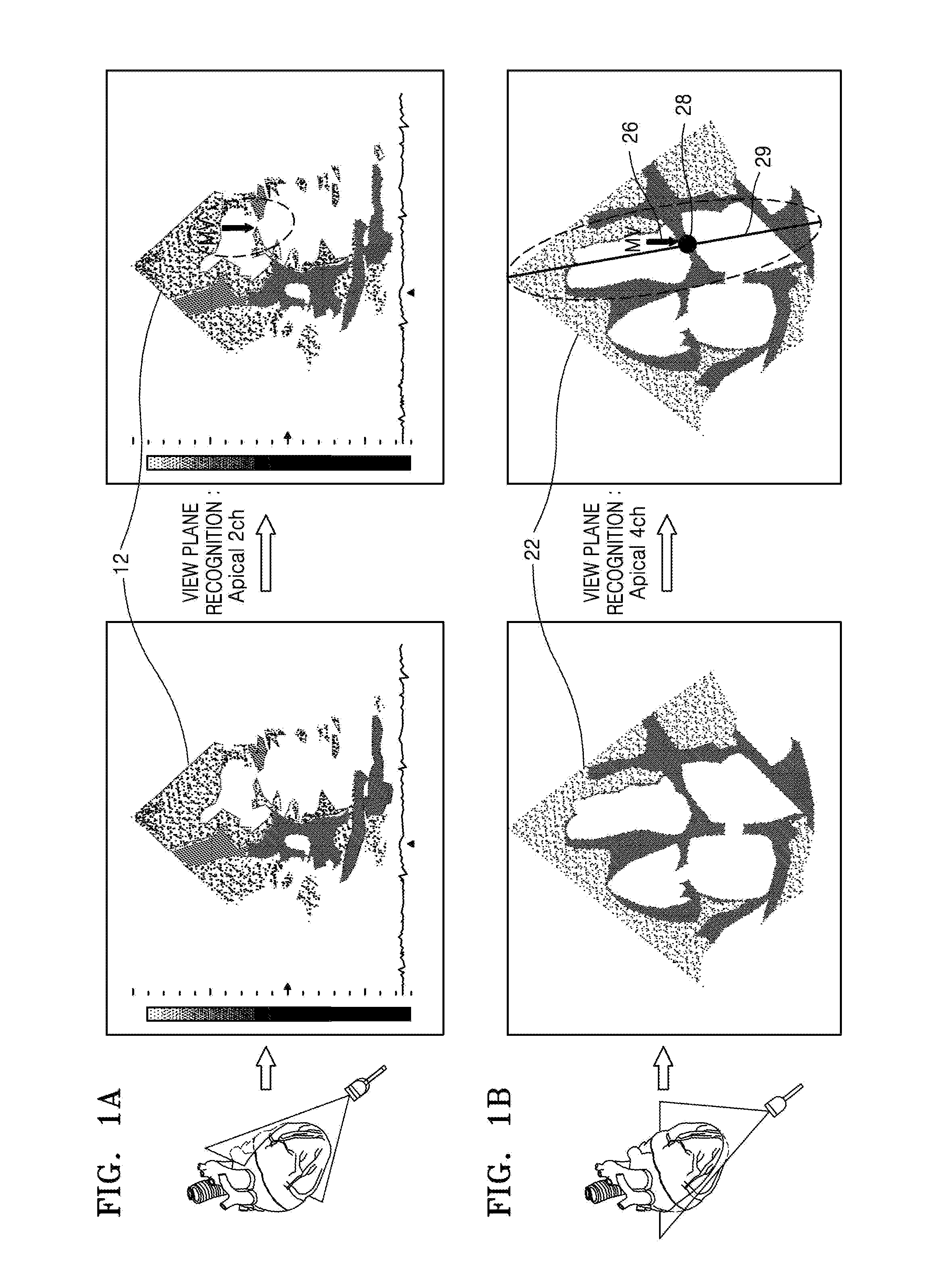 Ultrasound apparatus and method