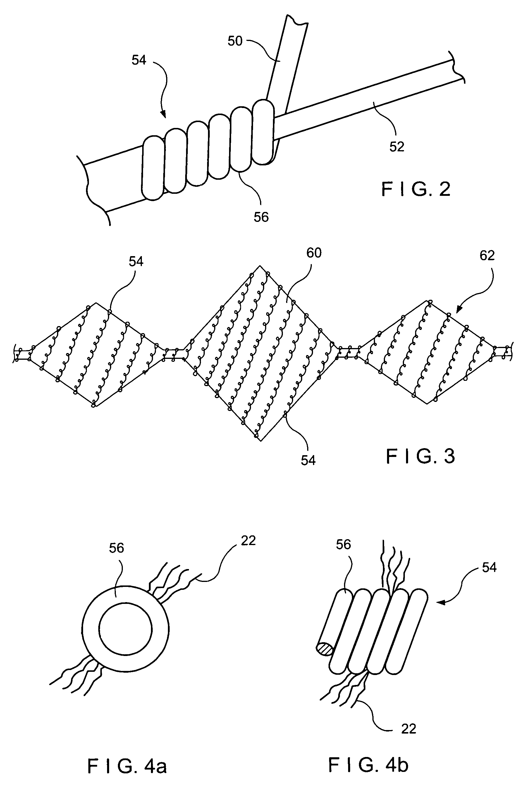 Embolic coil