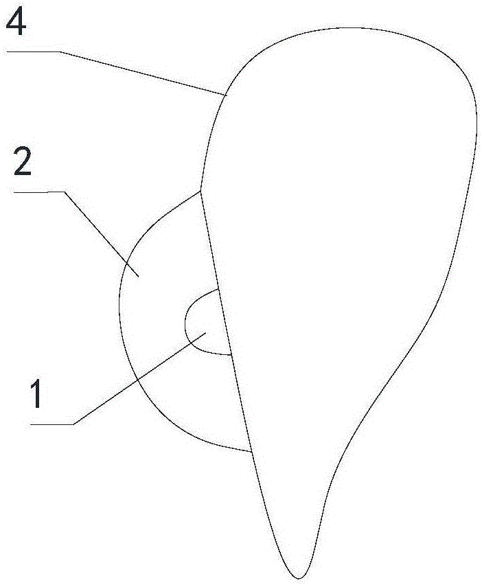 Method and device for correcting invisible photosensitive resin brackets