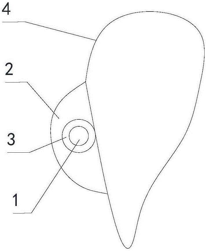 Method and device for correcting invisible photosensitive resin brackets